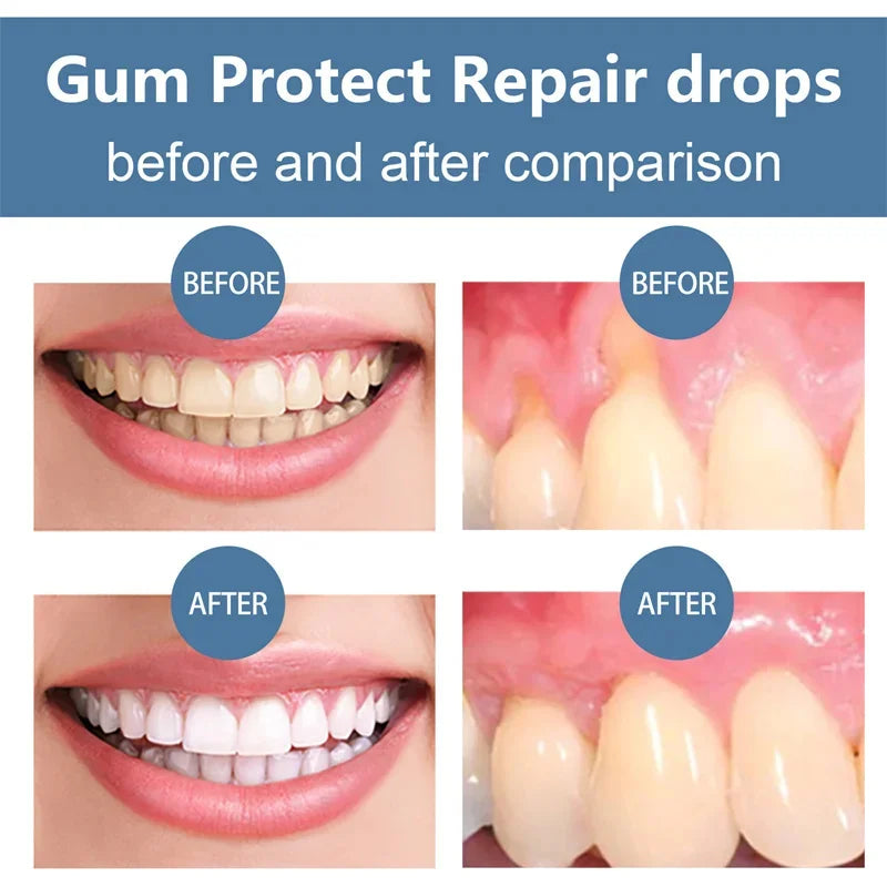 RAPID REPAIR GUMS SERUM EFFECTIVELY RELIEVE TOOTH ALLERGY